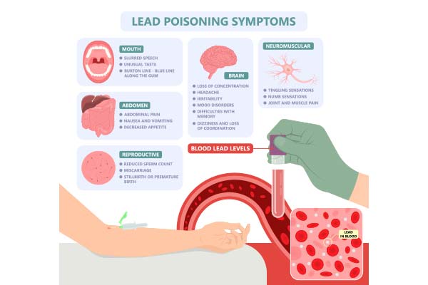 lead-paint-poisoning